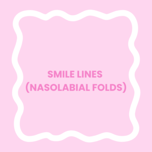 Smile Lines (Nasolabial Folds)