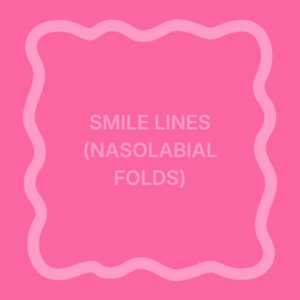 Smile Lines (Nasolabial Folds)